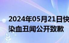 2024年05月21日快讯 英国首相苏纳克就污染血丑闻公开致歉